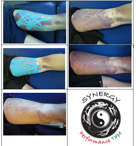 Performance Synergy Tape